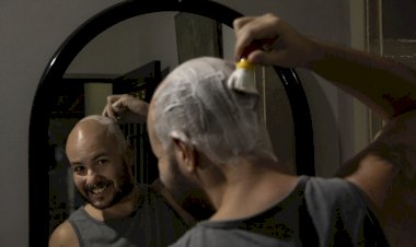Dos fiozinhos soltos à proteção solar: como homens com calvície podem cuidar da careca no dia a dia