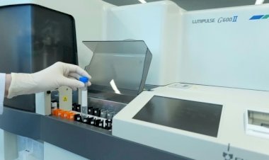 Exame de sangue para Alzheimer chega ao Brasil: veja quem pode fazer, quanto custa e o que o resultado revela