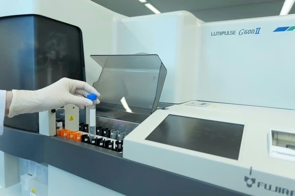 Exame de sangue para Alzheimer chega ao Brasil: veja quem pode fazer, quanto custa e o que o resultado revela